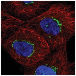 TMEM25 Antibody, Novus Biologicals 100&mu;L; Unlabeled:Antibodies, Polyclonal