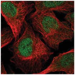 TMEM267 Antibody, Novus Biologicals 25 &mu;L, Unlabeled:Antibodies, Polyclonal