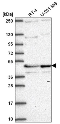 TMEM5 Antibody, Novus Biologicals:Antibodies:Primary Antibodies