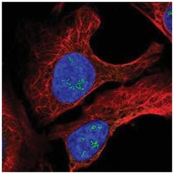 TMEM50B Antibody, Novus Biologicals 25 &mu;L, Unlabeled:Antibodies, Polyclonal