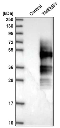 TMEM51 Antibody, Novus Biologicals 100&mu;L; Unlabeled:Antibodies, Polyclonal