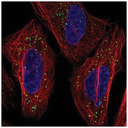 TMEM54 Antibody, Novus Biologicals 25 &mu;L, Unlabeled:Antibodies, Polyclonal