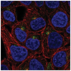 TMEM63A Antibody, Novus Biologicals 100 &mu;L | Buy Online | Novus Biologicals | Fisher Scientific