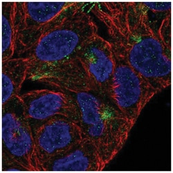 TMEM63A Antibody, Novus Biologicals 100 &mu;L | Buy Online | Novus Biologicals | Fisher Scientific