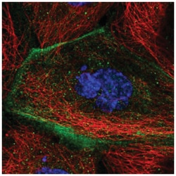 TMEM63B Antibody, Novus Biologicals:Antibodies:Primary Antibodies