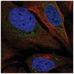 TMEM66 Antibody, Novus Biologicals:Antibodies:Primary Antibodies