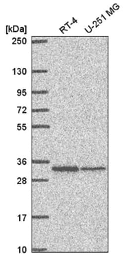 TMEM81 Antibody, Novus Biologicals 25 &mu;L, Unlabeled:Antibodies, Polyclonal