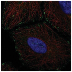 TMEM85 Antibody, Novus Biologicals 100 &mu;L | Buy Online | Novus Biologicals | Fisher Scientific