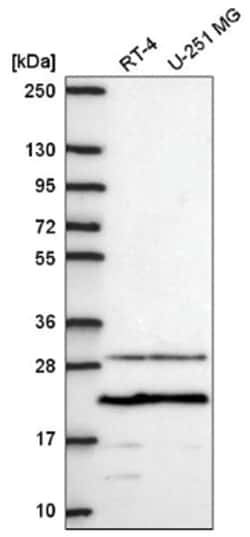 TMEPAI Antibody, Novus Biologicals 25 &mu;L, Unlabeled:Antibodies, Polyclonal