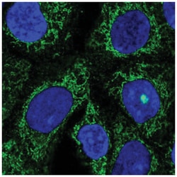 TMLHE Antibody, Novus Biologicals 100&mu;L; Unlabeled:Antibodies, Polyclonal