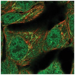 TNFAIP2 Antibody, Novus Biologicals 25 &mu;L:Antibodies, Polyclonal