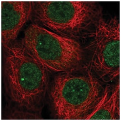 TNFAIP8 Antibody, Novus Biologicals 100&mu;L; Unlabeled:Antibodies, Polyclonal