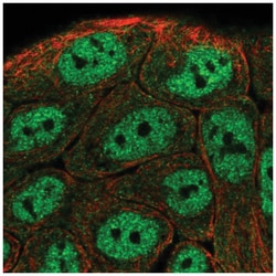 TNIP1 Antibody, Novus Biologicals:Antibodies:Primary Antibodies