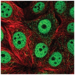 TOB1 Antibody, Novus Biologicals 25 &mu;L:Antibodies, Polyclonal