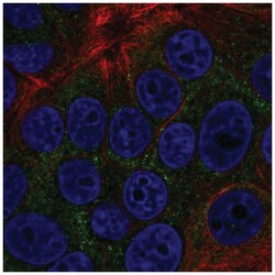 TOB2 Antibody, Novus Biologicals:Antibodies:Primary Antibodies