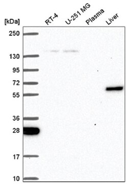 TOE1 Antibody, Novus Biologicals:Antibodies:Primary Antibodies