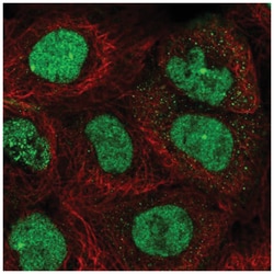 TopBP1 Antibody, Novus Biologicals 25 &mu;L:Antibodies, Polyclonal