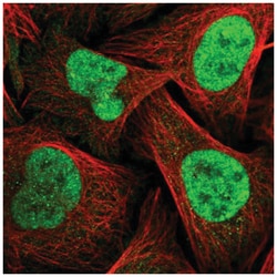 TopBP1 Antibody, Novus Biologicals 100&mu;L; Unlabeled:Antibodies, Polyclonal