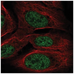 TOPORS Antibody, Novus Biologicals:Antibodies:Primary Antibodies