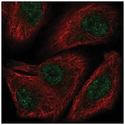 TOX2 Antibody, Novus Biologicals 100&mu;L; Unlabeled:Antibodies, Polyclonal