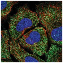 TPTE2 Antibody, Novus Biologicals 100&mu;L; Unlabeled:Antibodies, Polyclonal