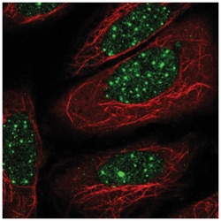 TR beta 1/NR1A2/Thyroid Hormone Receptor beta Antibody, Novus Biologicals