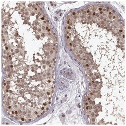 TR2/NR2C1 Antibody, Novus Biologicals:Antibodies:Primary Antibodies