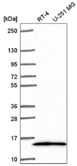 TRA16 Antibody, Novus Biologicals 100 &mu;L | Buy Online | Novus Biologicals | Fisher Scientific