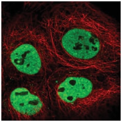 TRA2B Antibody, Novus Biologicals:Antibodies:Primary Antibodies