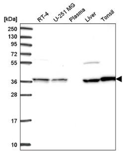 Transaldolase 1 Antibody, Novus Biologicals 100&mu;L; Unlabeled:Antibodies,