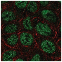 TRERF1 Antibody, Novus Biologicals:Antibodies:Primary Antibodies