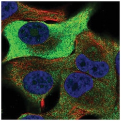 TRIB1 Antibody, Novus Biologicals:Antibodies:Primary Antibodies