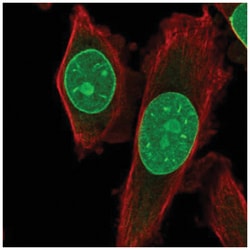 TRIB3 Antibody, Novus Biologicals 100&mu;L; Unlabeled:Antibodies, Polyclonal