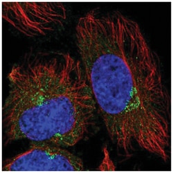 TRIM44 Antibody, Novus Biologicals 100&mu;L; Unlabeled:Antibodies, Polyclonal