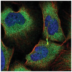 TRIM45 Antibody, Novus Biologicals 100 &mu;L | Buy Online | Novus Biologicals | Fisher Scientific