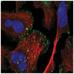 TRIM62 Antibody, Novus Biologicals 100&mu;L; Unlabeled:Antibodies, Polyclonal