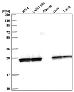 Triosephosphate isomerase Antibody, Novus Biologicals 100&mu;L; Unlabeled:Antibodies,