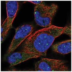 Tripeptidyl peptidase II Antibody, Novus Biologicals 100&mu;L; Unlabeled:Antibodies,