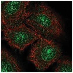 TrkC Antibody, Novus Biologicals 100&mu;L; Unlabeled:Antibodies, Polyclonal
