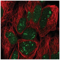 Trophinin Antibody, Novus Biologicals:Antibodies:Primary Antibodies