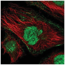 Troponin C (cardiac) Antibody, Novus Biologicals:Antibodies:Primary Antibodies