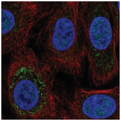 TRPC6 Antibody, Novus Biologicals:Antibodies:Primary Antibodies