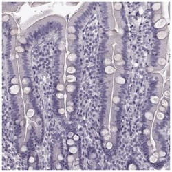 TRPM1 Antibody, Novus Biologicals:Antibodies:Primary Antibodies