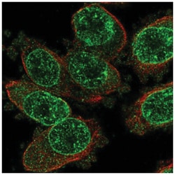TRPM2 Antibody, Novus Biologicals:Antibodies:Primary Antibodies