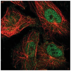 TRPM7 Antibody, Novus Biologicals:Antibodies:Primary Antibodies