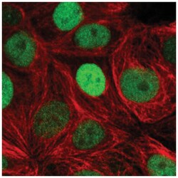 TRPS1 Antibody, Novus Biologicals 100&mu;L; Unlabeled:Antibodies, Polyclonal