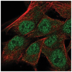 TRSPAP1 Antibody, Novus Biologicals 25 &mu;L, Unlabeled:Antibodies, Polyclonal