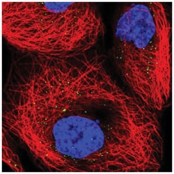 TRUB1 Antibody, Novus Biologicals 25 &mu;L:Antibodies, Polyclonal
