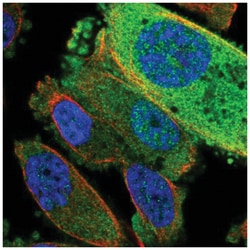 TRUB2 Antibody, Novus Biologicals 25 &mu;L, Unlabeled:Antibodies, Polyclonal