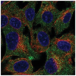 TRUSS Antibody, Novus Biologicals:Antibodies:Primary Antibodies
